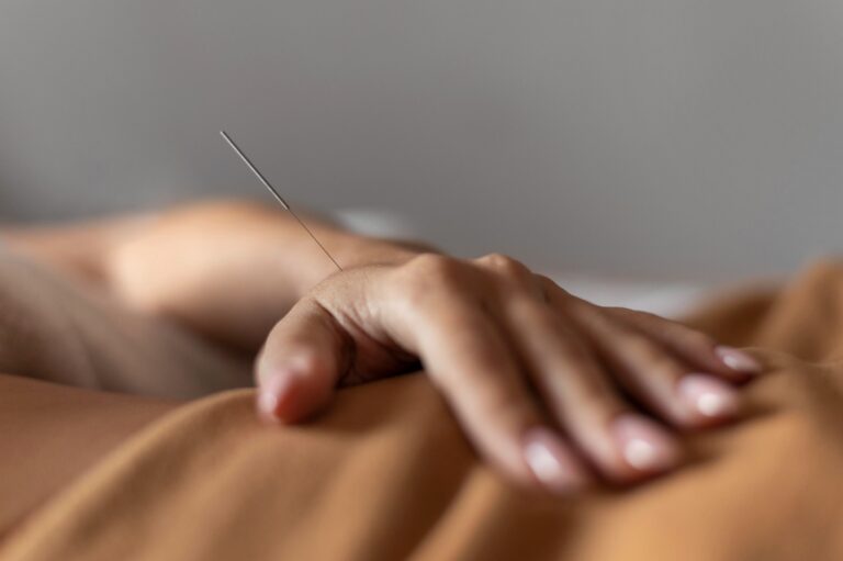 Lee más sobre el artículo La acupuntura puede reducir los síntomas de indigestión